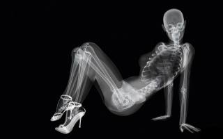 black background, skeleton, girl, x-rays